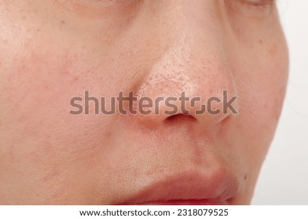 Around the nose of the face of a Japanese woman in her 40s