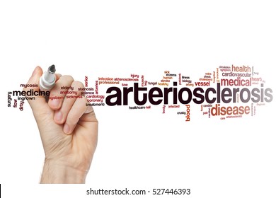 Arteriosclerosis word cloud concept - Shutterstock ID 527446393
