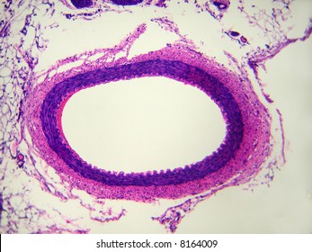 Artery Cross Section.