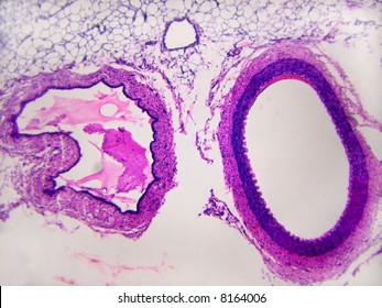 Artery And Vein Cross Section Showing Differences Between The Two