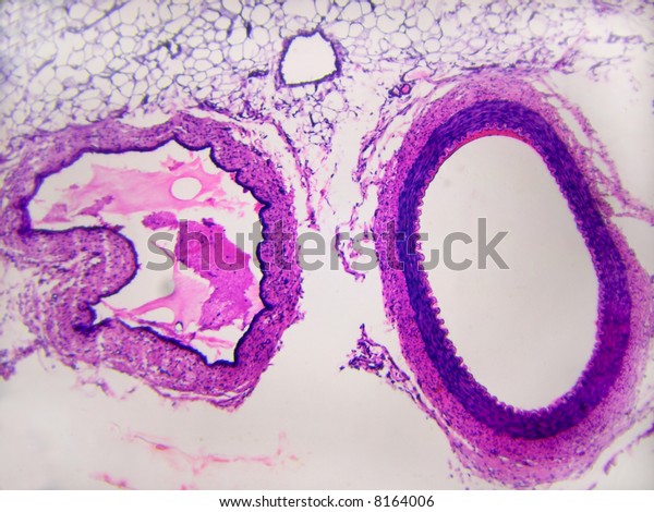Artery Vein Cross Section Showing Differences Stock Photo (Edit Now