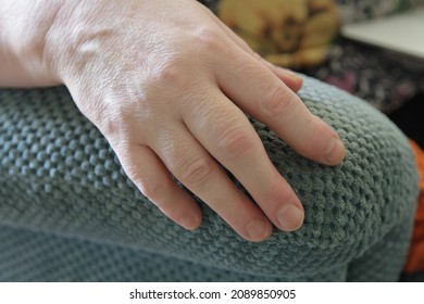 Arthritic Hand Resting On Armchair