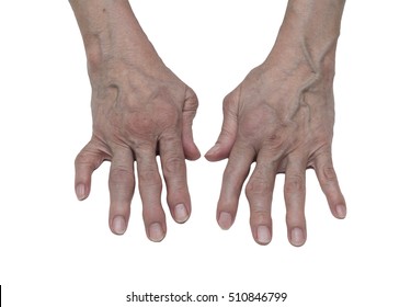 Arthritis Hands 260nw 510846799 