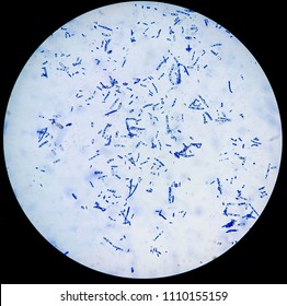 Arthroconidia Of Trichophyton Mentagrophytes, Culture On Potato Dextrose Agar 31 Day, Incubated At 25 °C