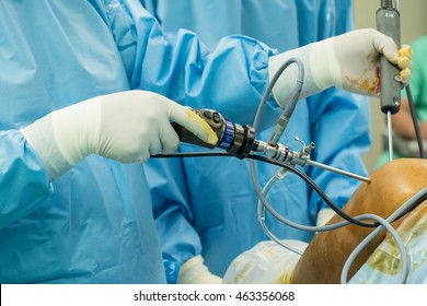arthroscope surgery