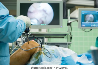 arthroscope surgery