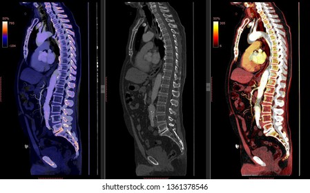 Artificial Intelligence In Medical Imaging/ Smart Healthcare Hospital Technology Concept/Computed Tomography Angiography (CTA)  