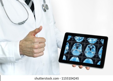 Artificial Intelligence In Smart Healthcare Hospital Technology Concept. Professional Doctor Use AI Biomedical Algorithm Detect Brain Pneumonia And Cancer Cell In Digital Filmless X-Rays Process.