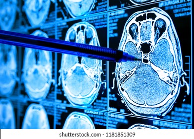 Artificial Intelligence In Smart Healthcare Hospital Technology Concept. Doctor Point Pen To AI Biomedical Algorithm Screen And Machine Learning Detect Brain Pneumonia , Cancer Cell In X-Rays Process.