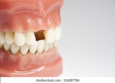 Artificial Jaw Missing A Tooth