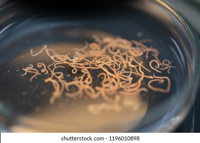 Ascariasis is a disease caused by the parasitic roundworm Ascaris lumbricoides for education in laboratories.
