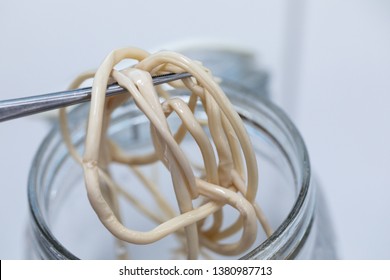 ascaris lumbricoides cause