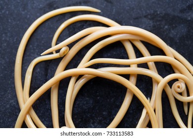 Ascariasis Disease Caused By Parasitic Roundworm Stock Photo 733113583 ...