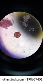 Ascariasis Lumbriciades In Microscopy At Parasite Laboratory