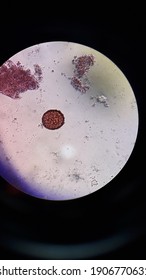 Ascariasis Lumbricoides Fertile Worm Eggs