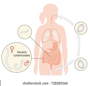 Ascaris lumbricoides it is the most common parasitic worm in humans. Infections with these parasites are common where sanitation is poor.