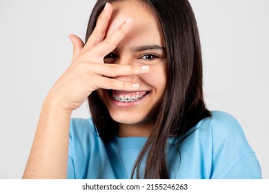 Ashamed And Funny Teen Girl With Braces Covering Face With Hand. Isolated On White