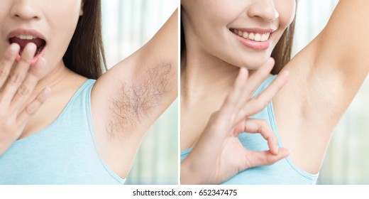 asia beauty woman with armpit plucking problem before and after