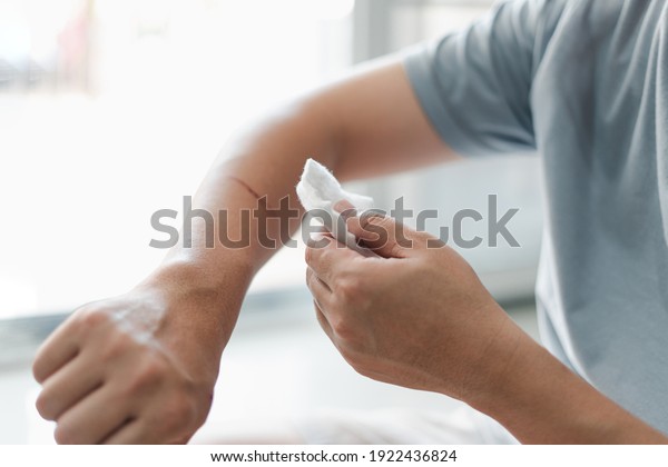 Asia\
man use medical cotton swab for cleaning and disinfection of wounds\
Cat scratch in First aid concept bleeding wounds\
