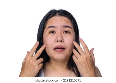 Asian adult woman face has freckles, large pores, blackhead pimple and scars problem from not take care for a long time. Skin problem face isolated white background. Treatment and Skincare concept - Shutterstock ID 2191215071