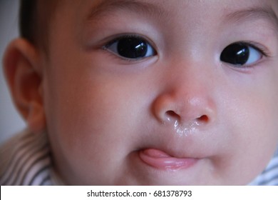 Asian Baby Boy Get A Cold Or Allergy,he Has Running Stuffy Nose,red Nose.,baby Get  Fever,sore Throat,mouth Throat,infection,Febrile Siezure.Feel Not Good.