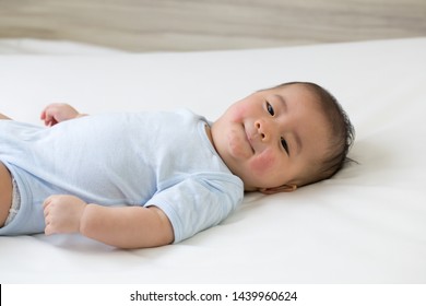 Asian Baby Boy Lying On The Bed And Had A Red Rash On The Face, Skin Common Rashes In Newborn Concept