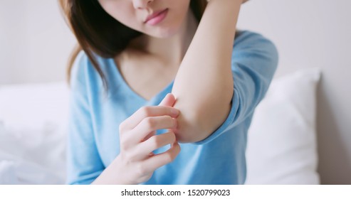 Asian Beauty Woman Has Dry Skin And Scratching Her Elbow