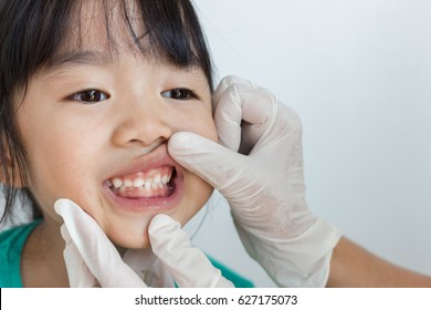 Asian Child Show Her Primary Teeth ,she Has Teeth Check Up By The Dentist 