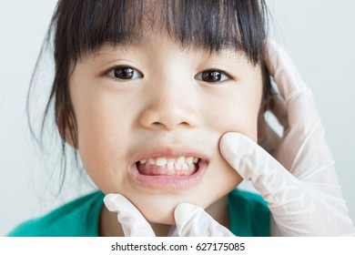 Asian Child Show Her Primary Teeth ,she Has Teeth Check Up By The Dentist 