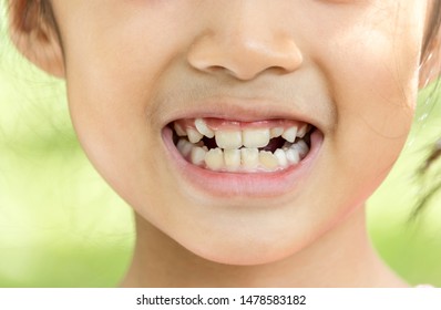 asian child smile and show her crowding tooth - Shutterstock ID 1478583182
