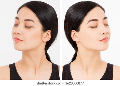 Asian close up woman happy face before after cosmetic procedures. Skin care wrinkled face, dark circles under eyes. Before-after anti-aging facelift treatment. Facial skincare, beauty contouring