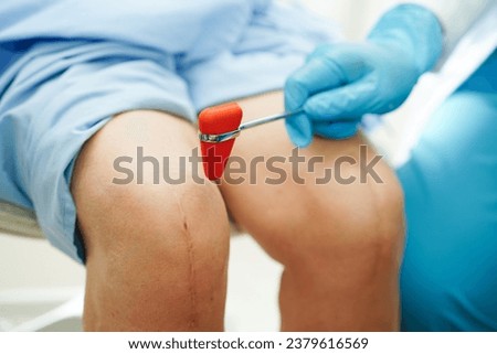 Asian doctor knock on knee reflex nerve for check and treatment senior patient in hospital.