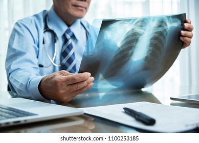 Asian Elderly Male Doctor In Blue Shirt Holding And Looking To Cancer X-ray Film Patient At A Medical Room At Hospital. Diagnosis Disease About Lung. Covid-19, Coronavirus.