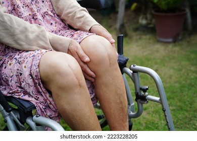 Asian Elderly Woman Patient With Scar Knee Replacement Surgery In Hospital.