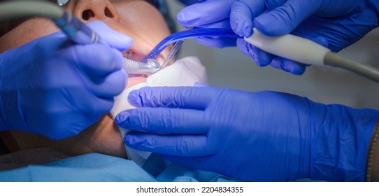 Asian Female Patient On Dentist Appointment During Dental Procedure. Human Mouth Open Close Up. Spot Light In A Face. Dentist Makes Initial Examination, Cleaning Teeths And Oral Cavity Of The Patient.