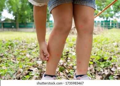 Asian girl has allergies with mosquitoes bite and itching her leg.Mosquito blood breeding on kids.Repellent, Dengue virus, Yellow fever, West nile, Malaria, Diseases Spread by Mosquitoes concept.