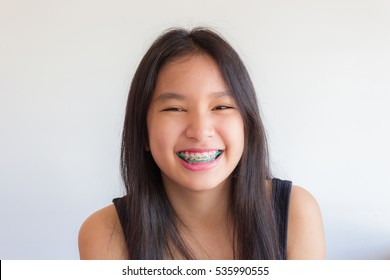 asian girl has braces and she smile happily
