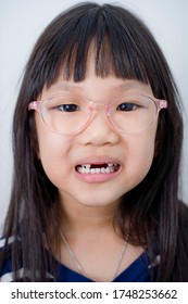 Asian Girl Laughing And Being Goofy Showing His Lost Teeth.