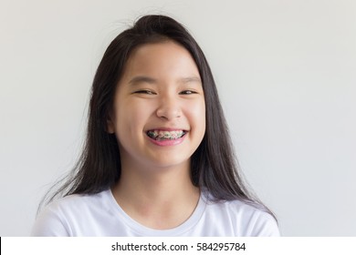 asian girl smile with braces