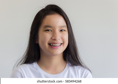 asian girl smile with colorful braces