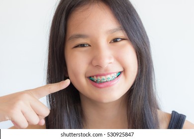 asian girl smile and point at her teeth , she has braces