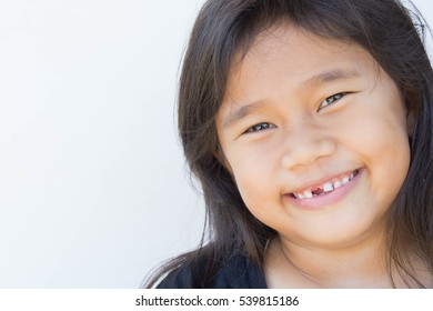 Asian girl smiling broken tooth