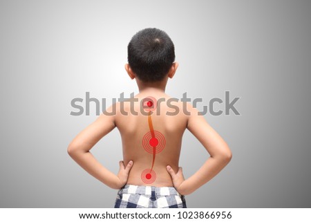 Asian kid with scoliosis, isolated on white background