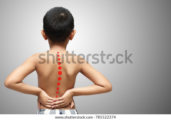 Asian Kid Scoliosis Isolated On White Stock Photo (Edit Now) 785522374