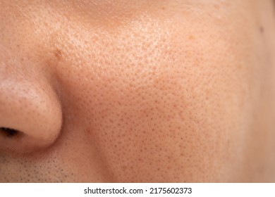Asian male nose and cheek close up has skin problem, large pores, whitehead and blackhead pimple. Pores on the face of a man. - Shutterstock ID 2175602373