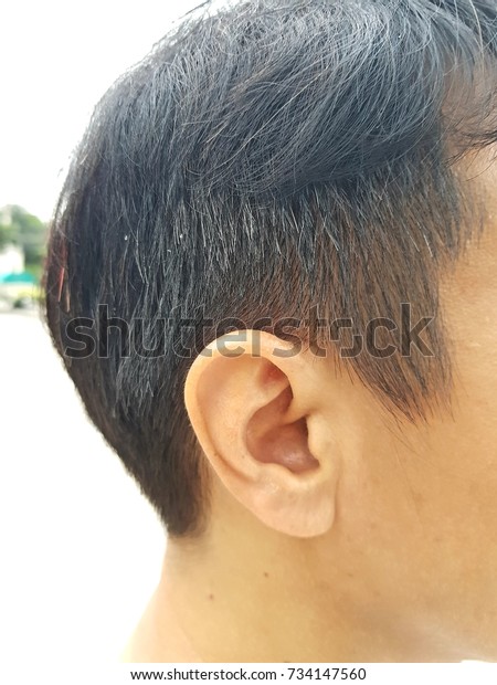 Asian Male Shows Problem Gray Hair Stock Photo Edit Now 734147560