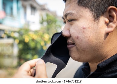 Asian Man With Acne On The Face Caused By Wearing Cloth Face Mask,bacteria From Sweat,skin Inflammation,young Male Have Pimples,allergic,skin Allergy From Put A Face Mask,problems Of Inflamed Acne