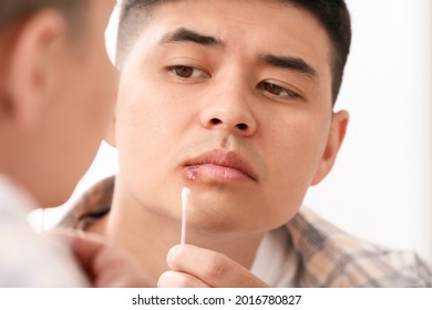 Asian Man With Cold Sore Applying Ointment On His Lips Near Mirror