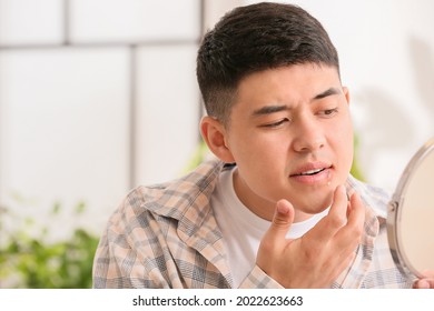 Asian Man With Cold Sore Applying Ointment On His Lips