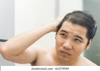 Balding Asian Man Front Images Stock Photos Vectors Shutterstock